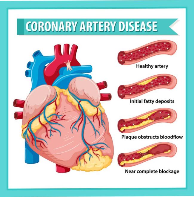 cardiologist-in-baner-pune-dr-benny-jose